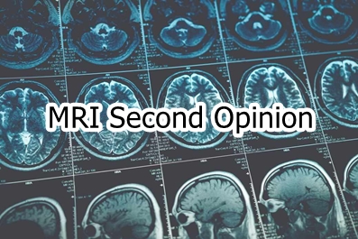 MRI Second Opinion